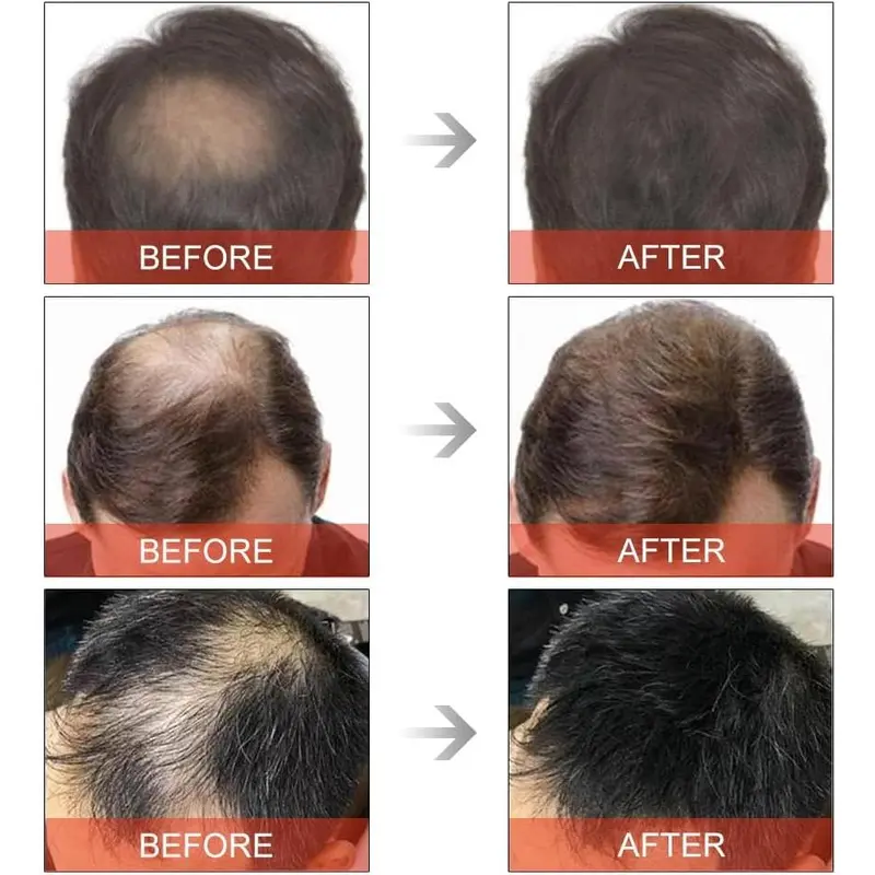 Hair Building Fibers,Natural Hair Fibers for Men & Women,Hair Fibres Black,Hair Powder for Thinning Hair,Easily Cover & Waterproof,Hair Loss Concealer,Instantly Conceals Hair Loss Hairline-Black 2