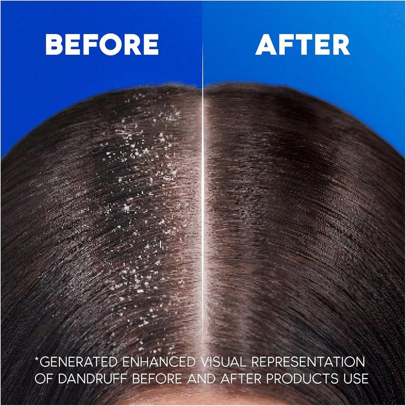 Head & Shoulders Classic Clean Anti-Dandruff 2-in-1 Shampoo, 1000 ml Conditioner Haircare Cleanser Cleansing 3