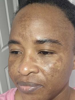 Product Review of Beauty Balm serum Boosted skin Tint- Concealer -Makeup- Cosmetic from m**a 1