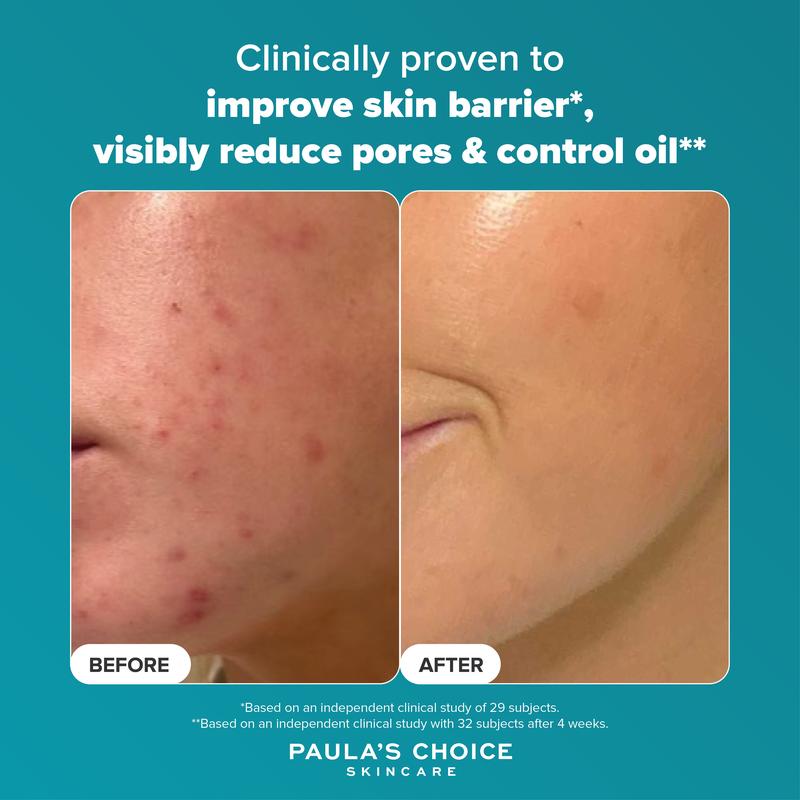 Paula's Choice SKIN PERFECTING 2% BHA Liquid Exfoliant - 118 ml 5