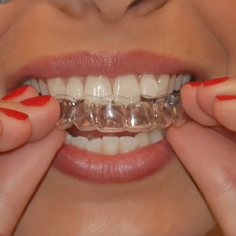 3pcs Sleep Better And Protect Your Teeth With A Dental Mouth Guard - Stop Grinding And Clenching Your Teeth At Night 0