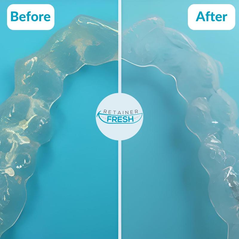 Product Introduction of 120 Tablets Oral Cleaning Set - Retainer Fresh, Brite, and Stain-Free - Retainer Cleaner, Mouth Guard, Dentures, Aligners 4
