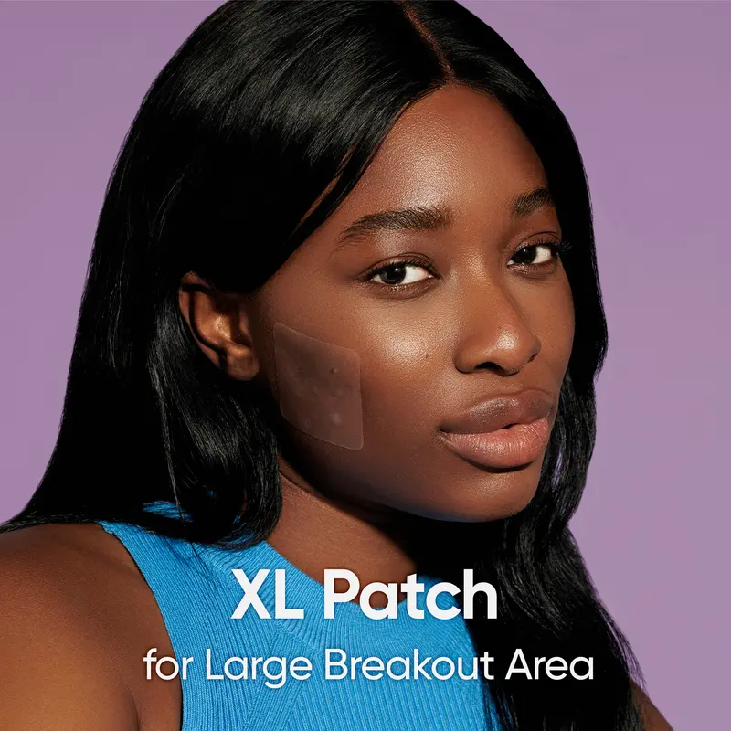 Breakout Patch Classic’s Holy Grail | Face, Body, Nose & Pimple Patches Bundle | Award-Winning | Hydrocolloid Acne Patch & Pore Strips to Absorbs Pus & Oil, Unclog & Shrink Pores | Spot Treatment + Blackhead Remover | Vegan & Cruelty-Free 8