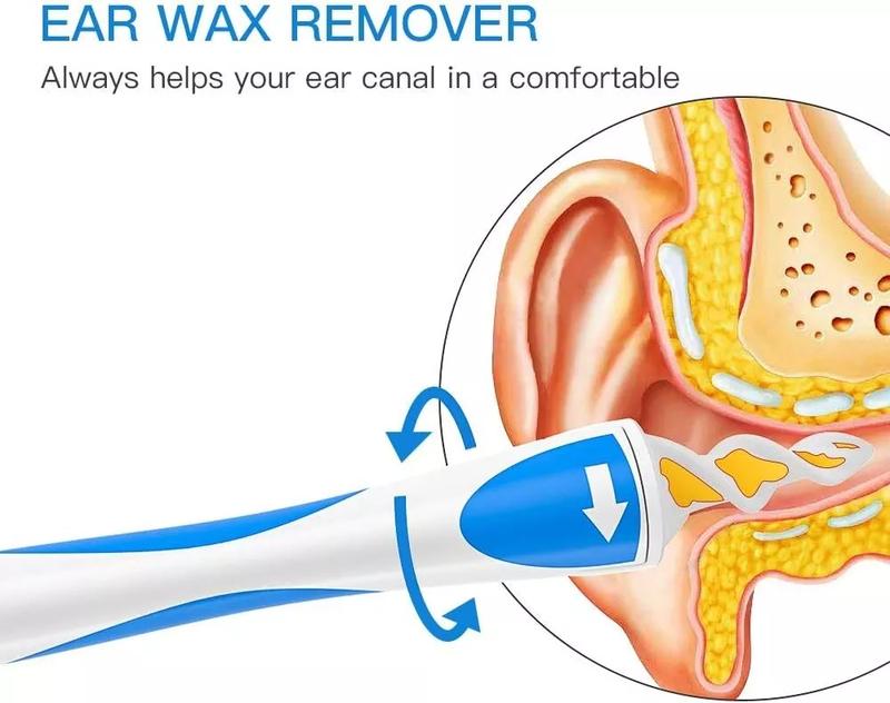 Product Introduction of Smart Ear Wax Cleaner - Safe & Soft Spiral Earwax Removal Tool for Easy Cleaning! 25