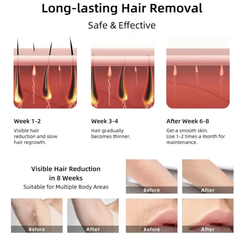 IPL Laser Hair Remover for Face and Body - Portable Electric Home Handle Permanent Removal 2