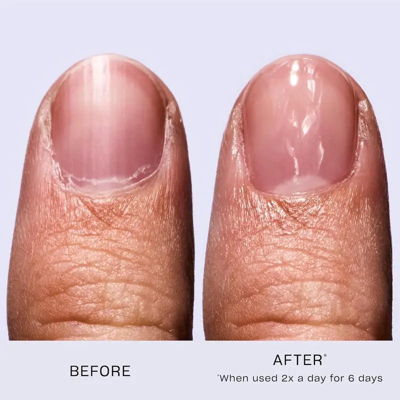 OPI Nail Envy Nail Polish, Nail Strengthener Treatment with Biotin, Calcium & Vitamins for Strong Natural Nails, Vegan Nail Repair and Strength for Damaged Nails, Clear Nail Polish 15ml Cutics Manicure Cosmetic 2