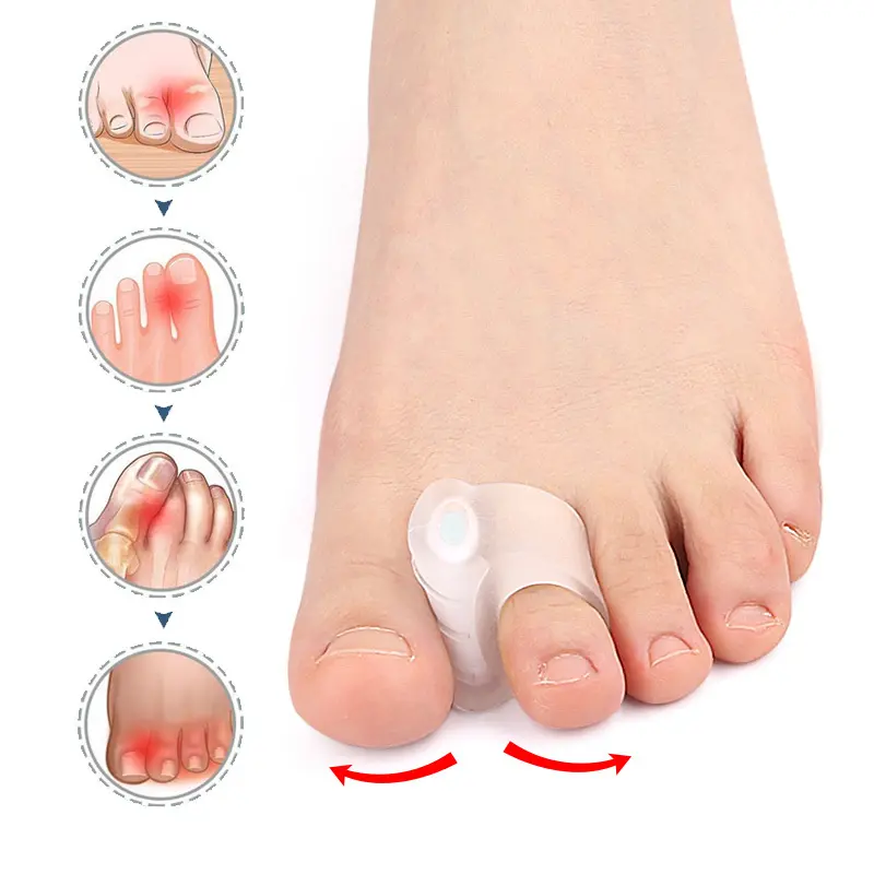 1 Pair of High Elastic Silicone Toe Separators + 6 Adjustable Pads, Special for Big Toes, Super Soft and Comfortable, Long-term Care Protector for Men and Women