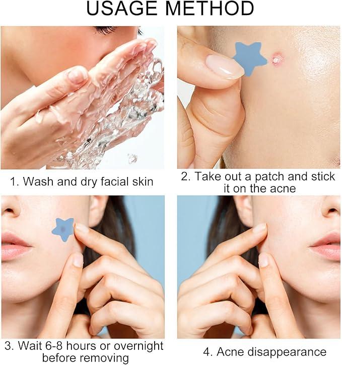 200pcs Hydrocolloid Acne Patches,Acne Patch Pimple Patch,Hydrocolloid Patches for Pimples, Blemishes, Zits, Acne Patches for Face Skincare 2