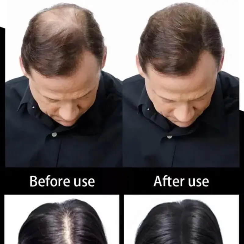 Toppik Hair Building Fibers - BLACK and DARK BROWN 27.5g - UK STOCK 5
