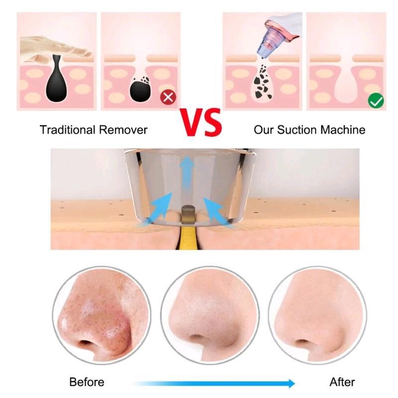 Electric Blackhead Remover Pore Nose Sucker Pimple Skin Acne Face Cleaner Vacuum Facial Skin Care Comfort Daily 4